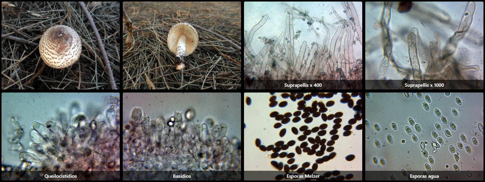 Microscopía de Lepiota brunneoincarnata