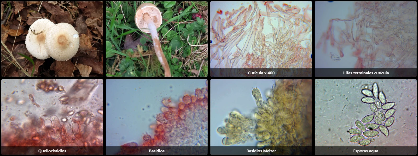 Microscopía de Lepiota ignivolvata