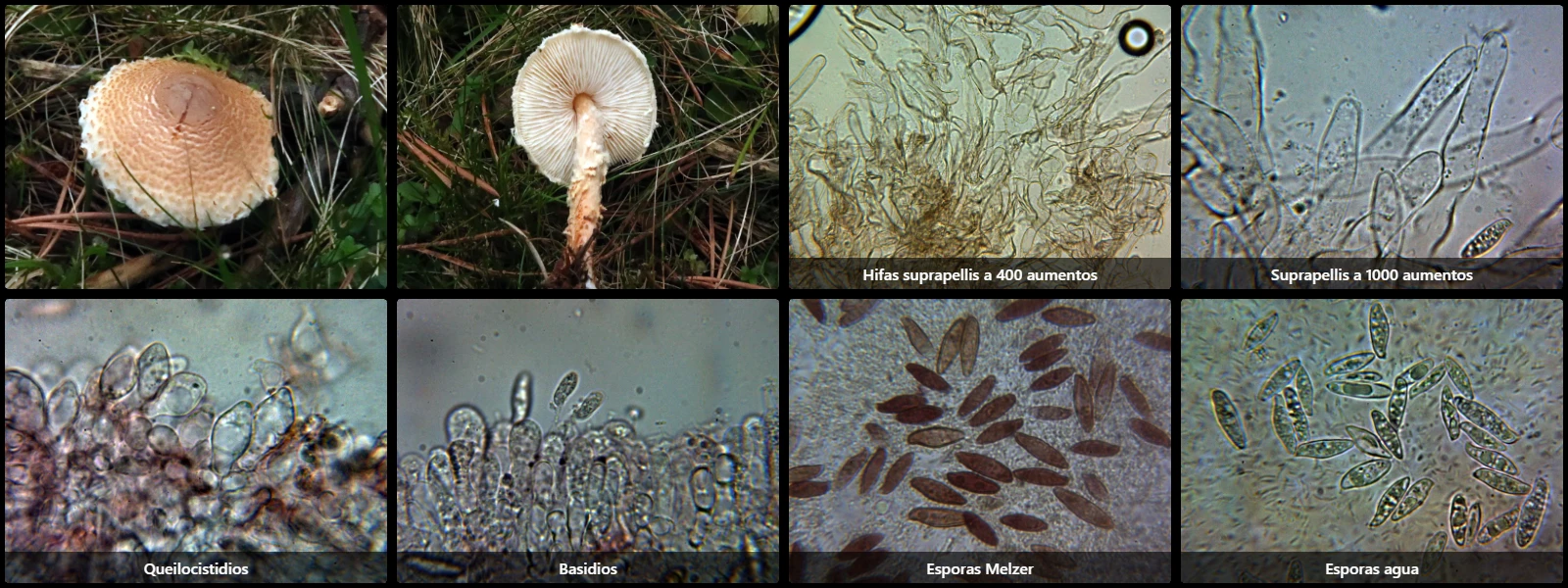 Microscopía de Lepiota magnispora