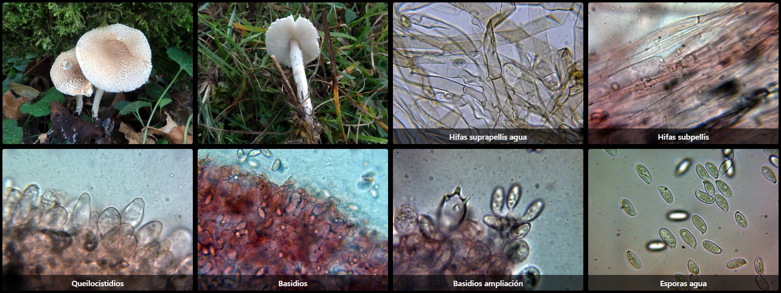 Microscopía de Lepiota subgracilis