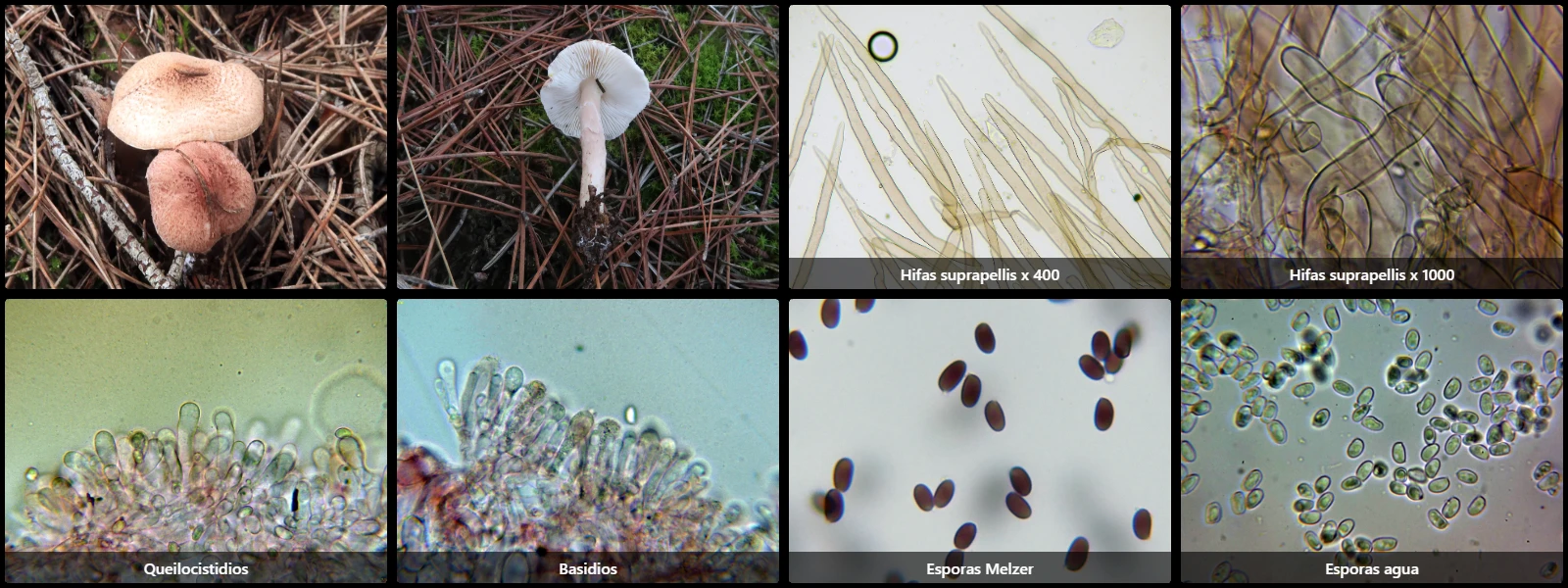 Microscopía de Lepiota subincarnata