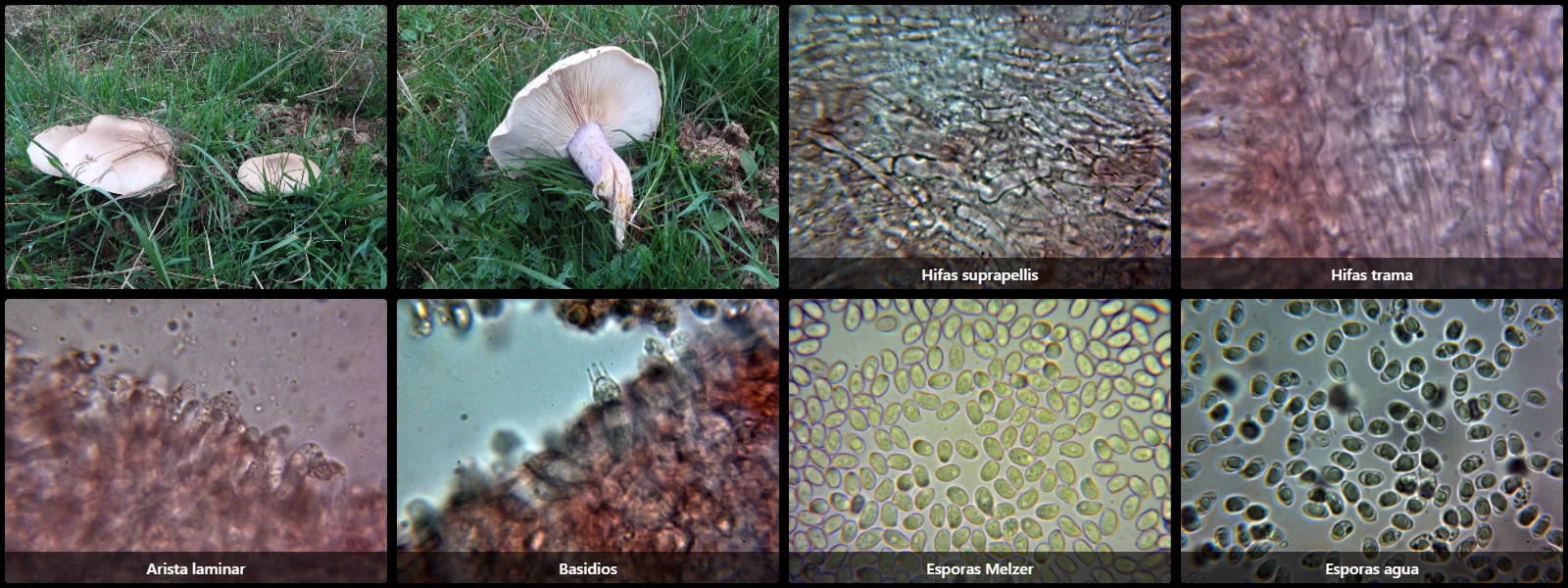 Microscopía de Lepista personata