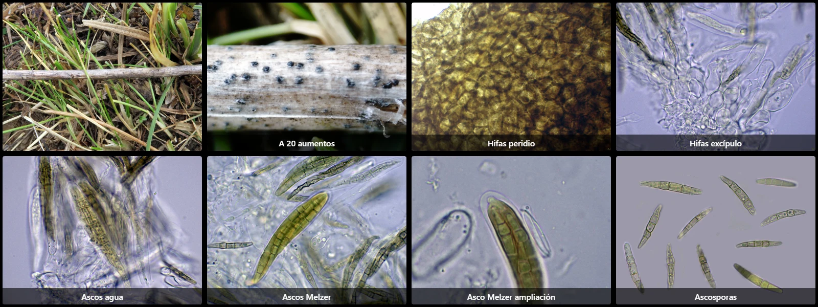 Leptosphaeria modesta
