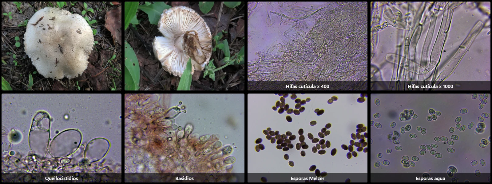 Microscopía de Leucoagaricus barssii