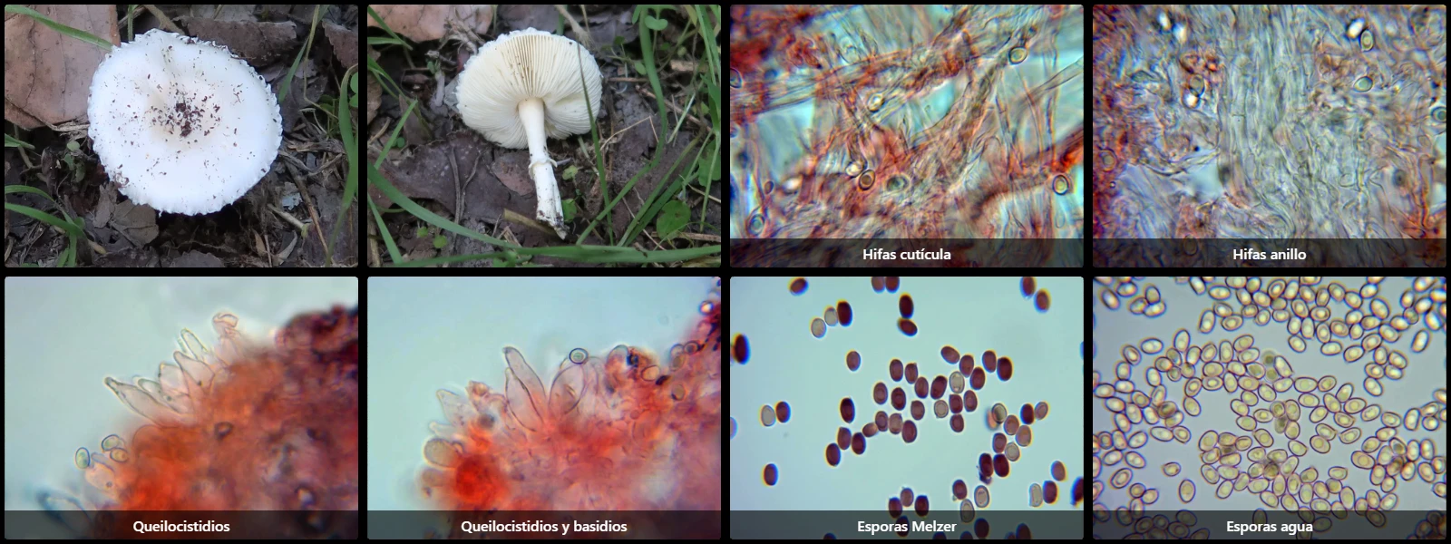 Microscopía de Leucoagaricus serenus