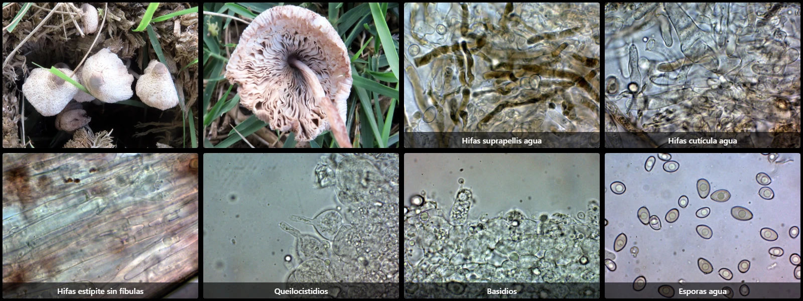 Microscopía de Leucocoprinus cepistipes