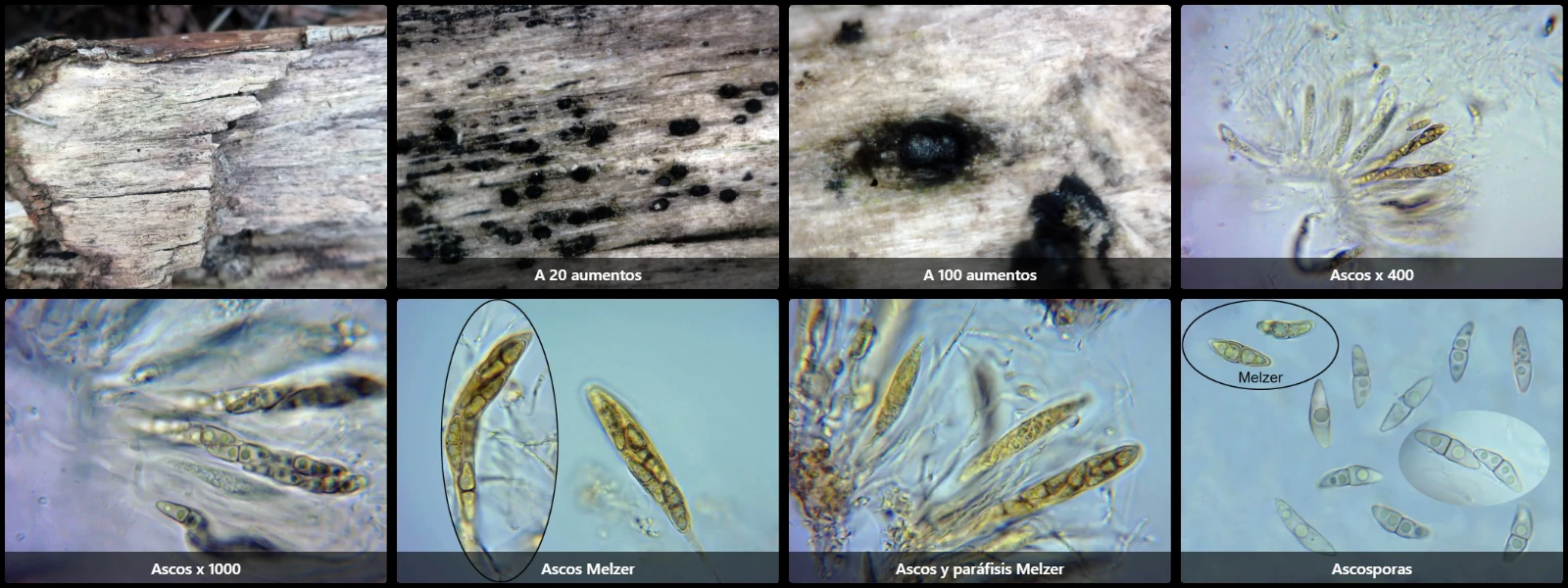 Microscopía de Lophiotrema rubi