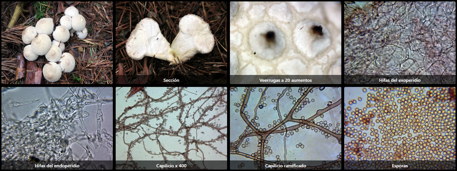 Microscopía de Lycoperdon perlatum