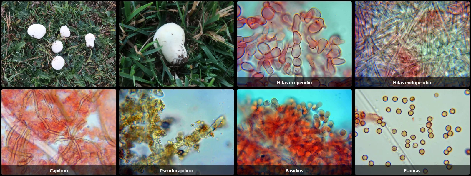 Microscopía de Lycoperdon pratense