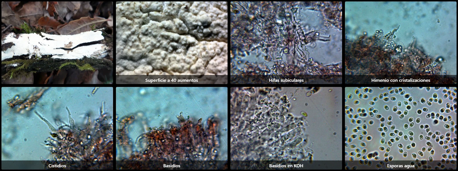 Microscopía de Lyomyces juniperi