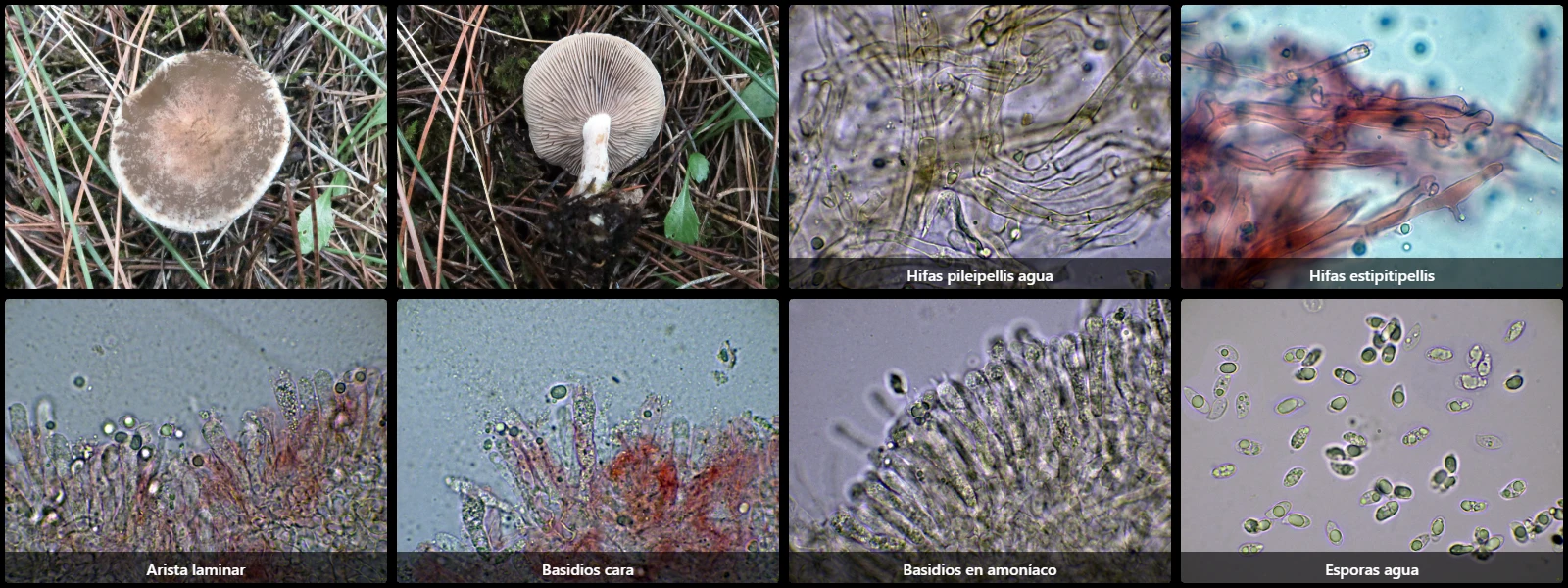 Microscopía de Lyophyllum admissum