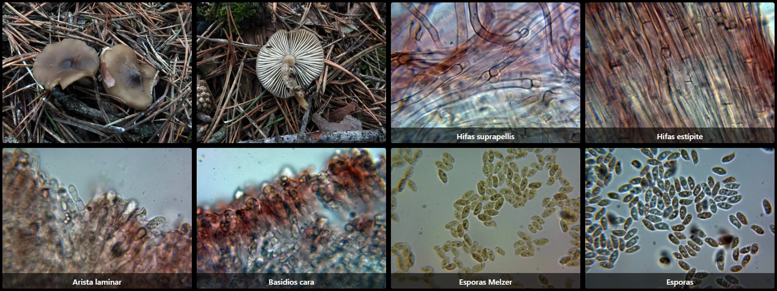 Microscopía de Lyophyllum aemiliae