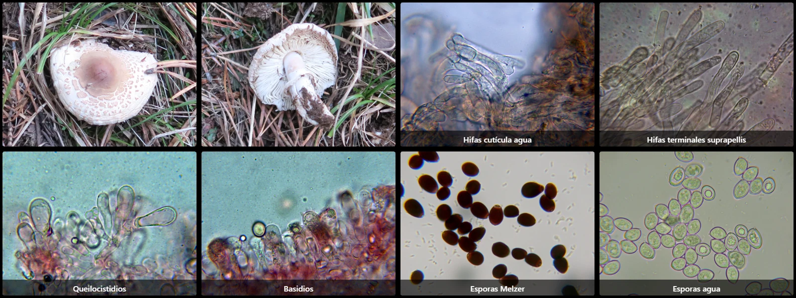 Microscopía de Macrolepiota mastoidea