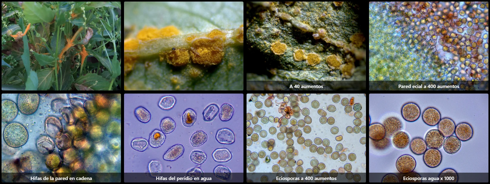Microscopía de Melampsora pulcherrima