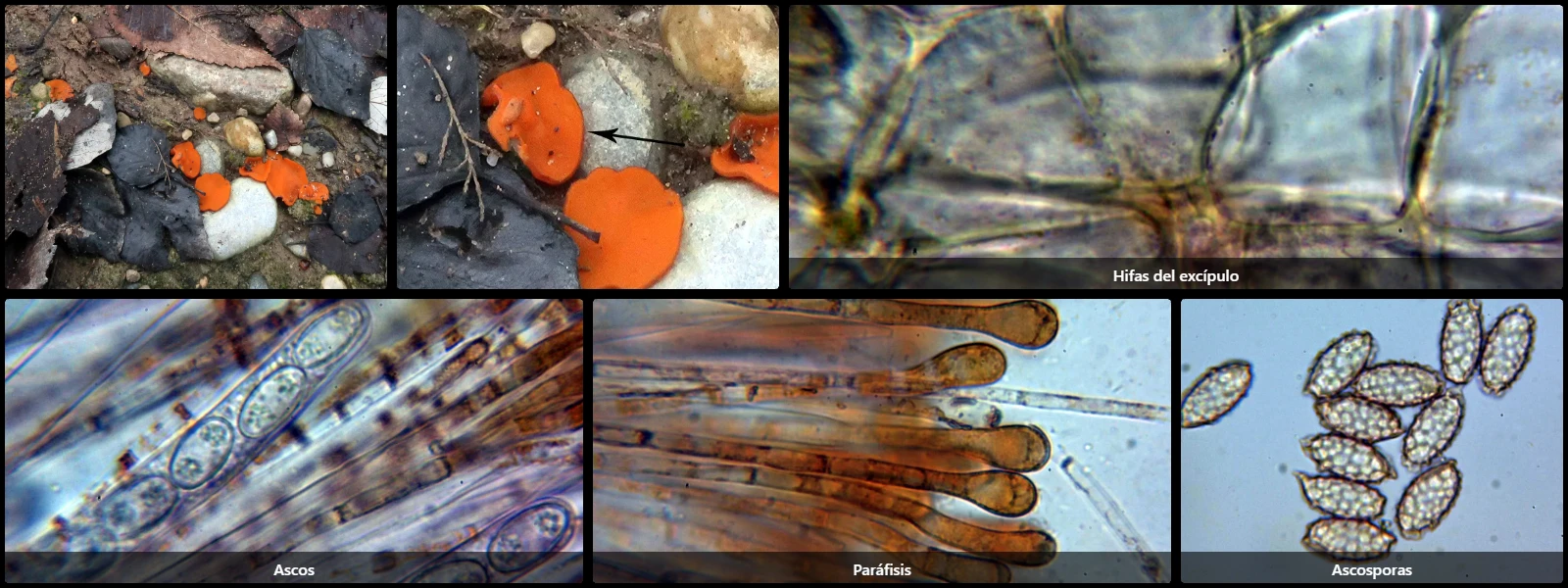 Microscopía de Melastiza chateri
