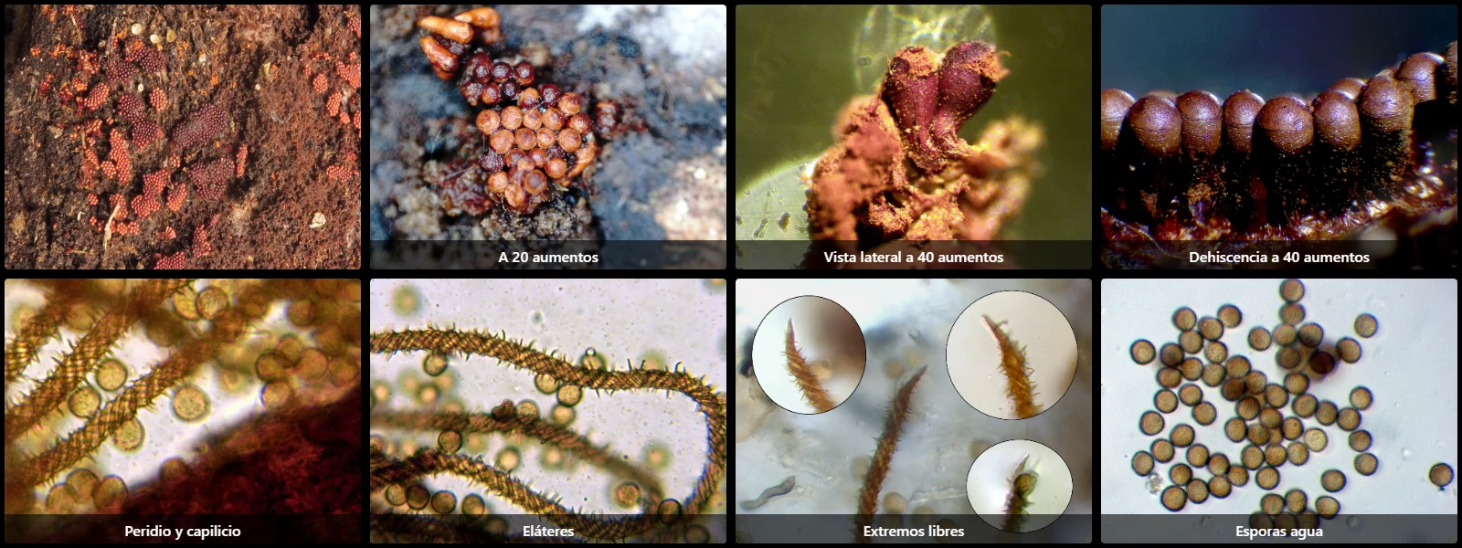Microscopía de Metatrichia horrida