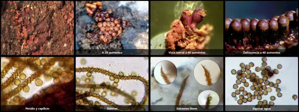 Microscopía de Metatrichia horrida