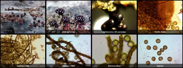 Microscopía de Metatrichia vesparia