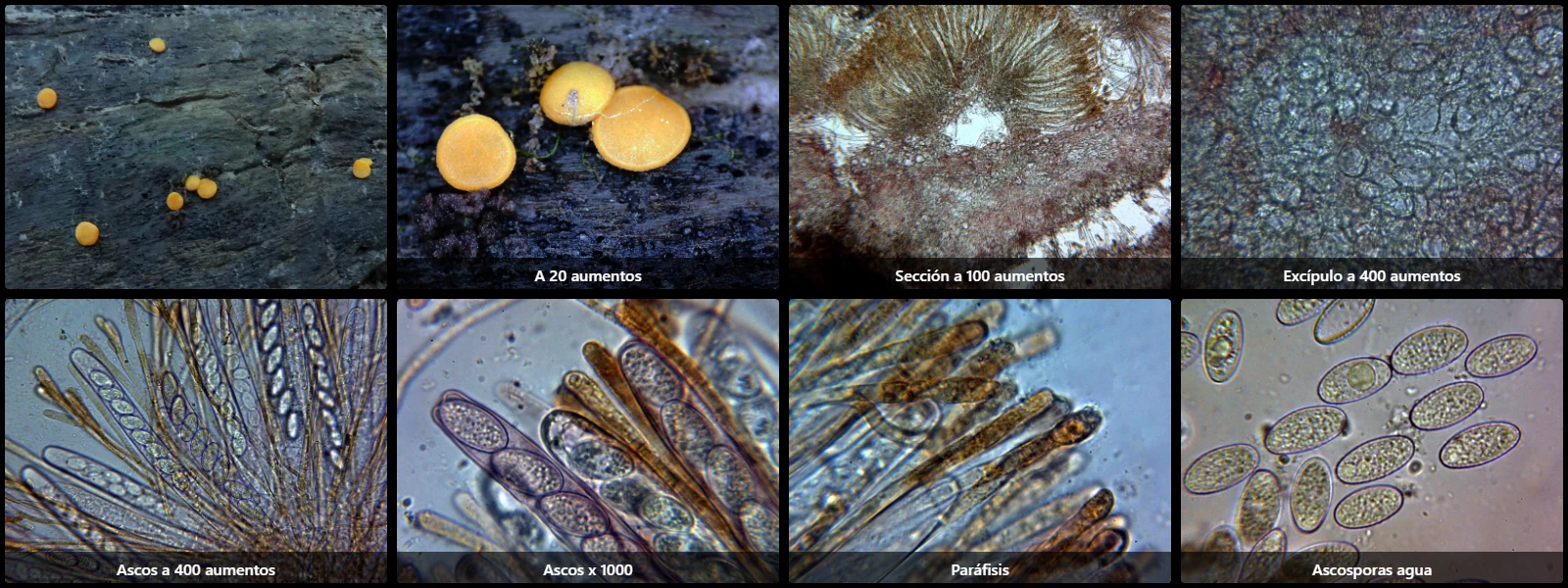 Microscopía de Miladina lecithina