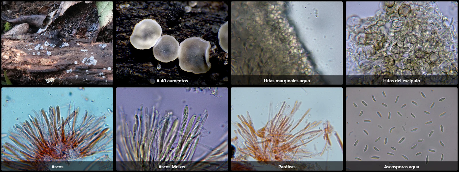 Microscopía de Mollisia cinerea