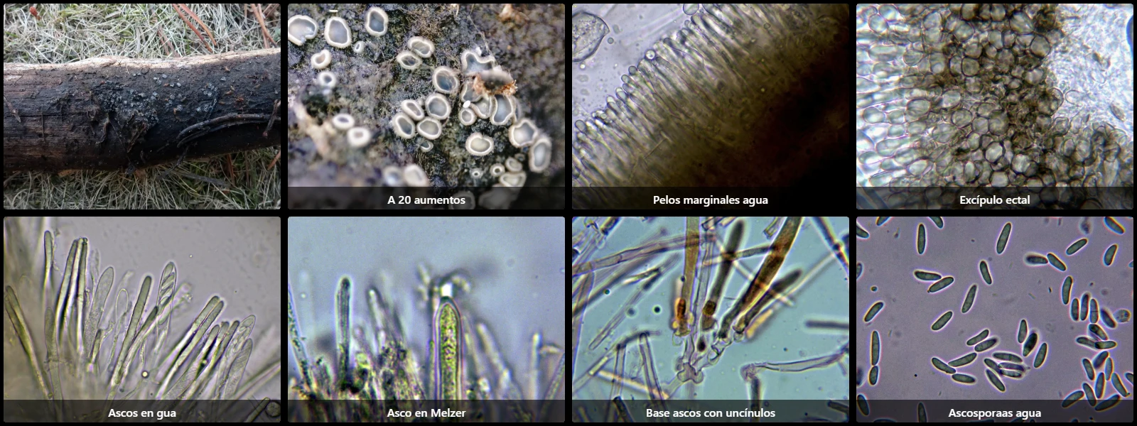 Microscopía de Mollisia ponticulorum