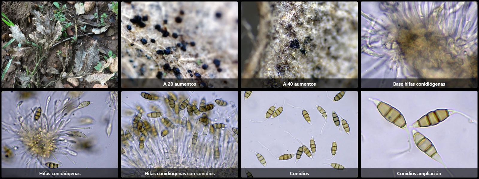 Microscopía de Monochaetia monochaeta