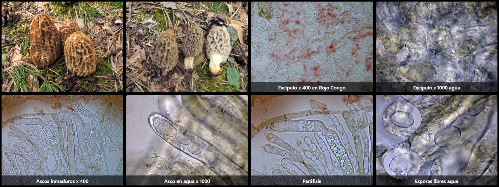 Microscopía de Morchella tridentina