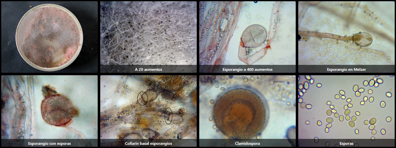 Microscopía de Mucor racemosus
