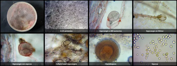 Microscopía de Mucor racemosus