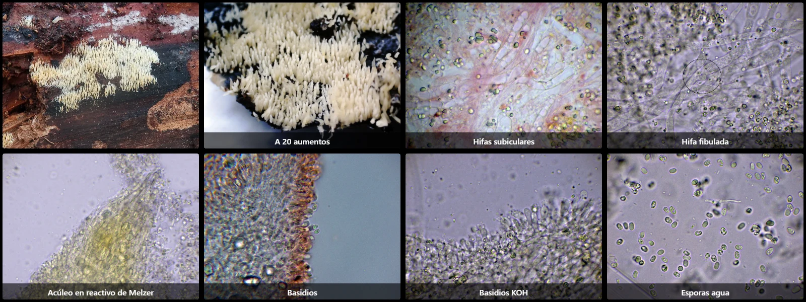Microscopía de Mucronella calva