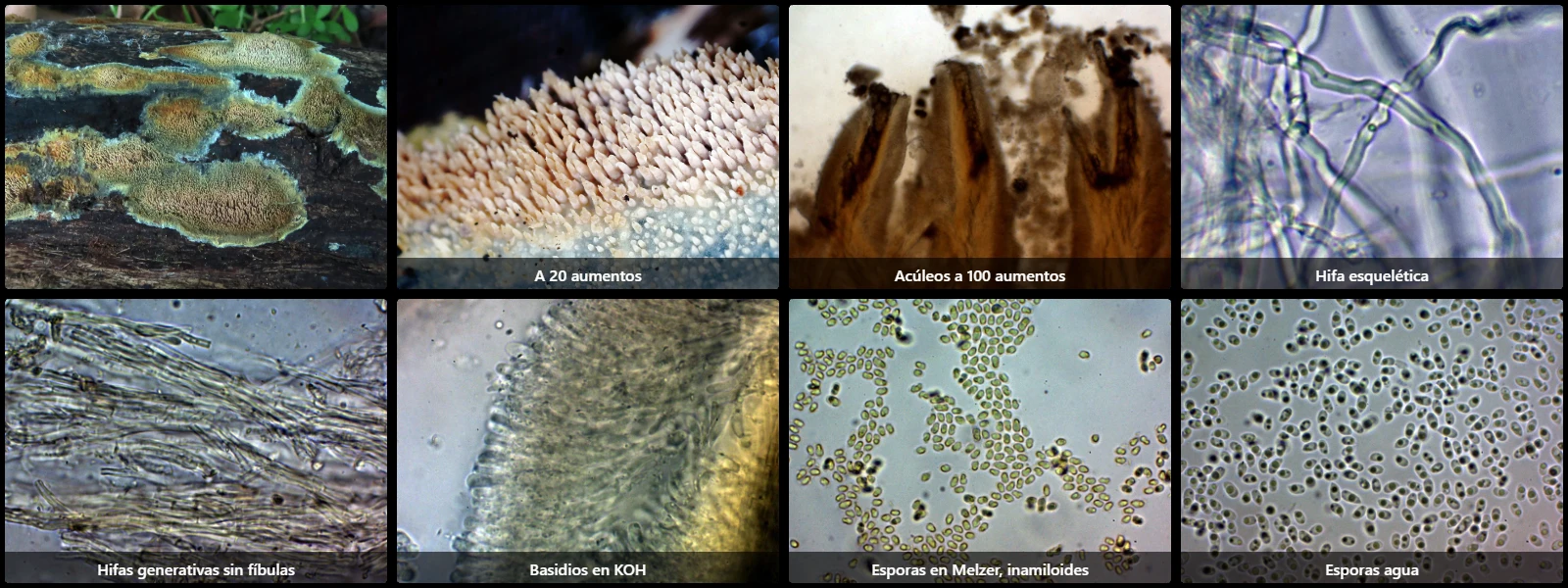 Microscopía de Mycoaciella efibulata