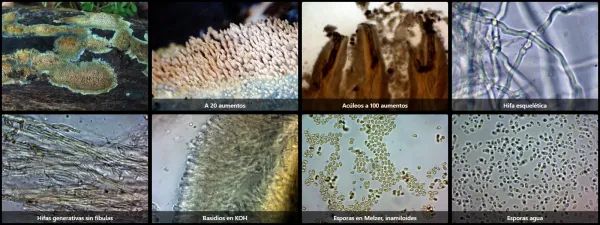 Microscopía de Mycoaciella efibulata