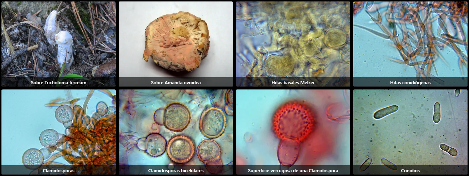 Microscopía de Mycogone rosea