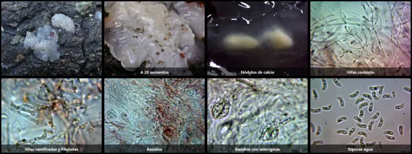 Microscopía de Myxarium nucleatum