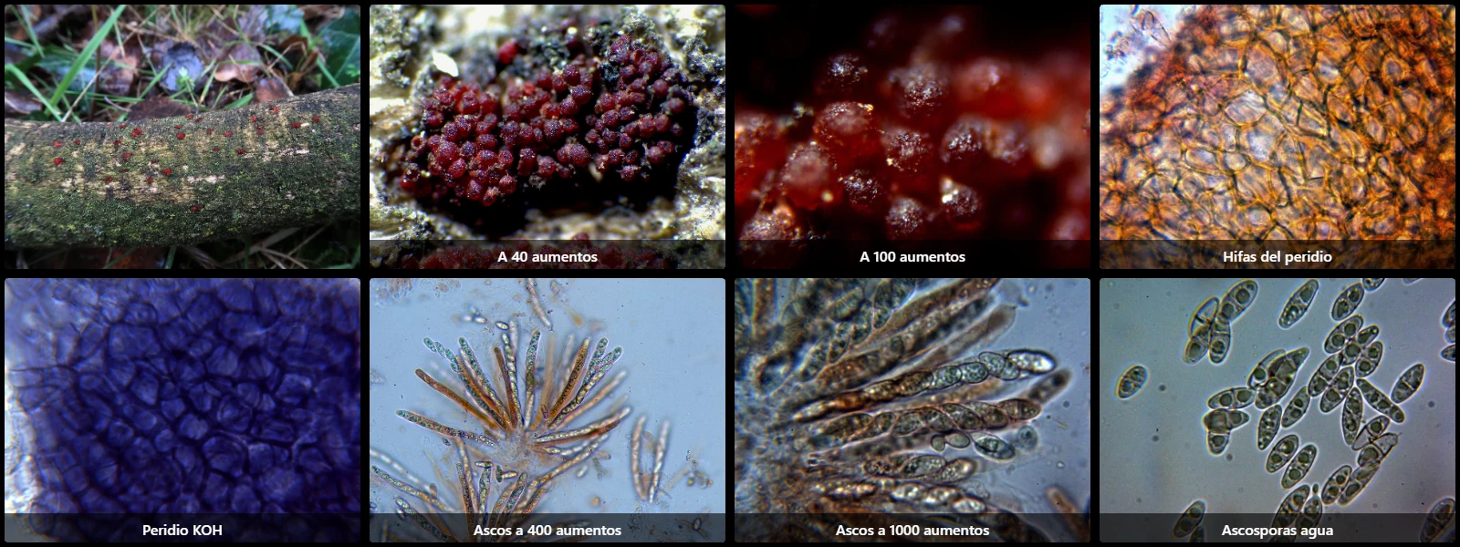 Microscopía de Nectria cinnabarina