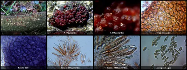 Microscopía de Nectria cinnabarina