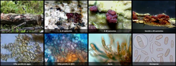 Microscopía de Nectria mariae