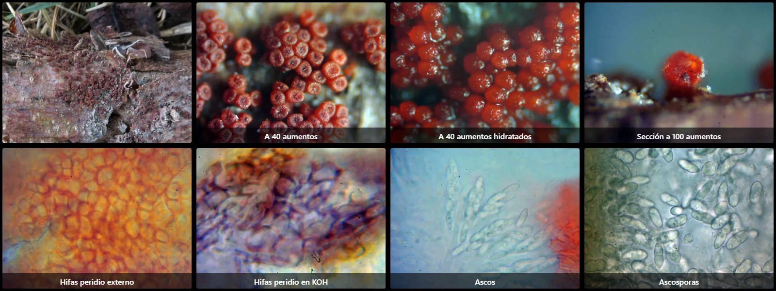 Microscopía de Nectria pseudocinnabarina