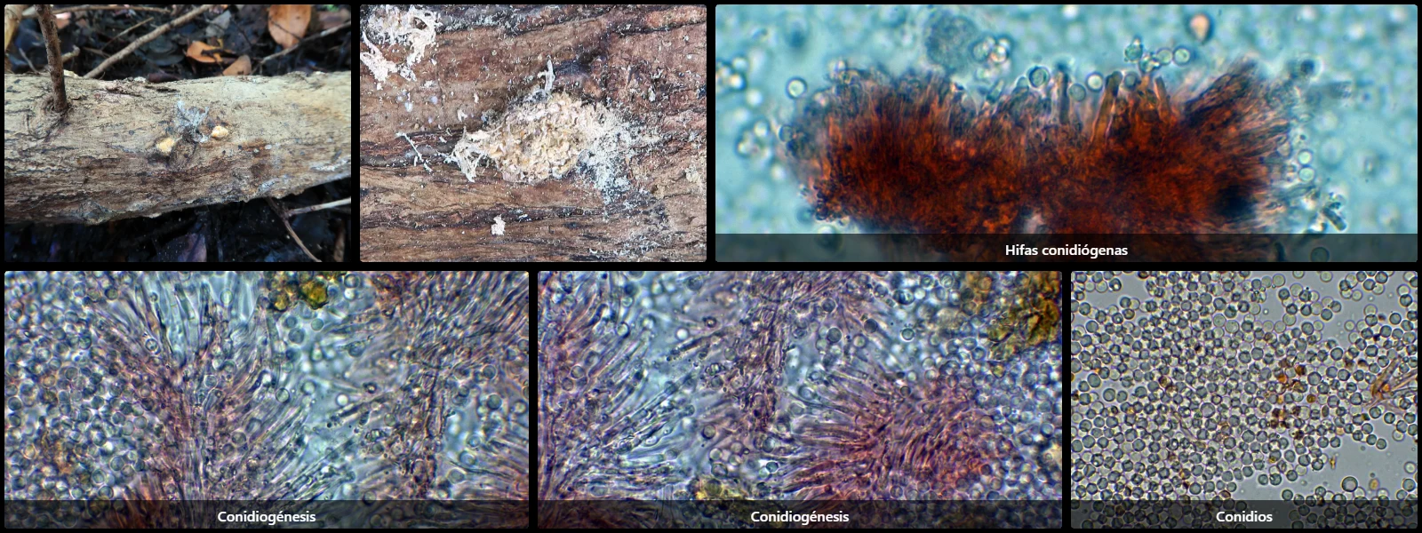 Microscopía de Nectria rubropeziza