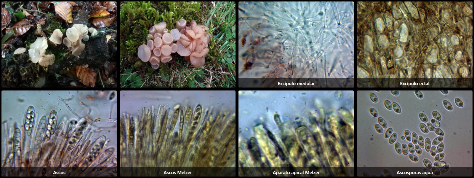 Microscopía de Neobulgaria pura