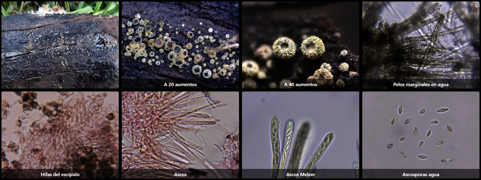 Microscopía de Neodasyscypha cerina