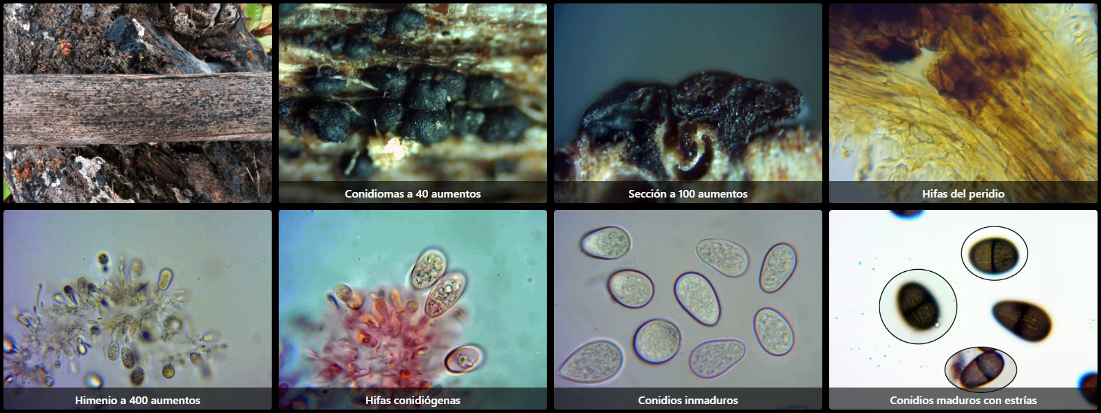 Microscopía de Neodeightonia phoenicum