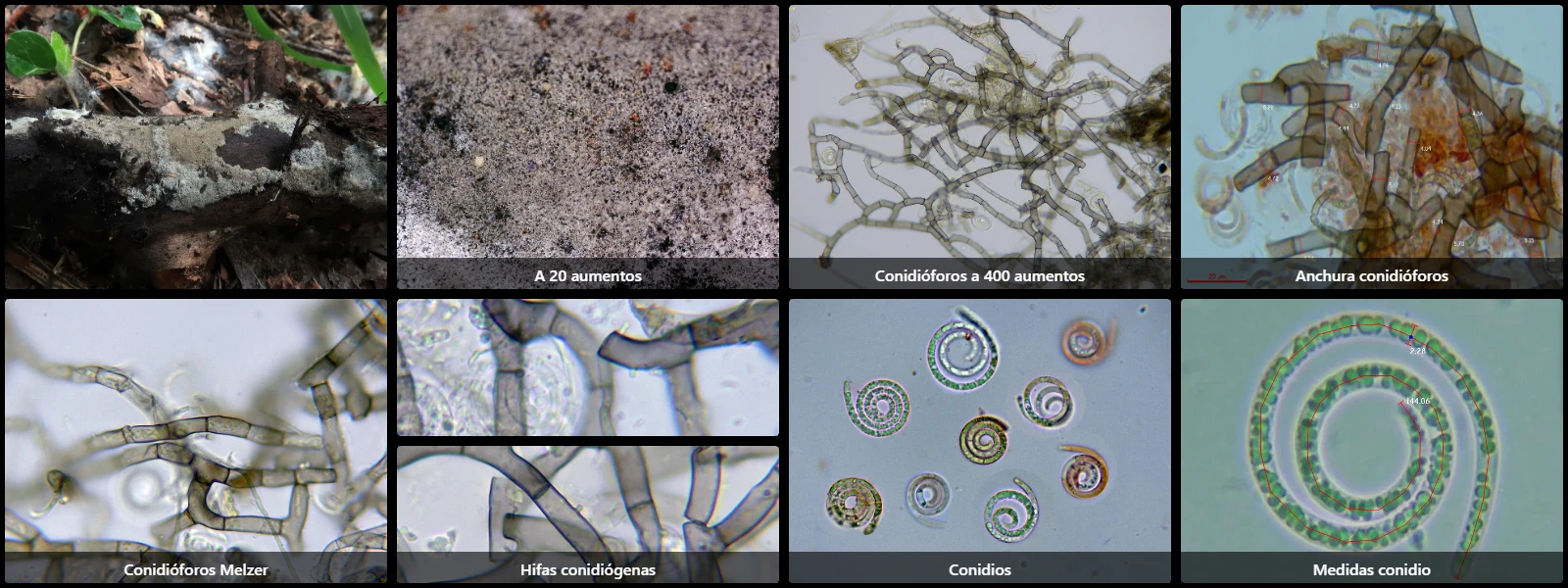 Microscopía de Neohelicosporium griseum