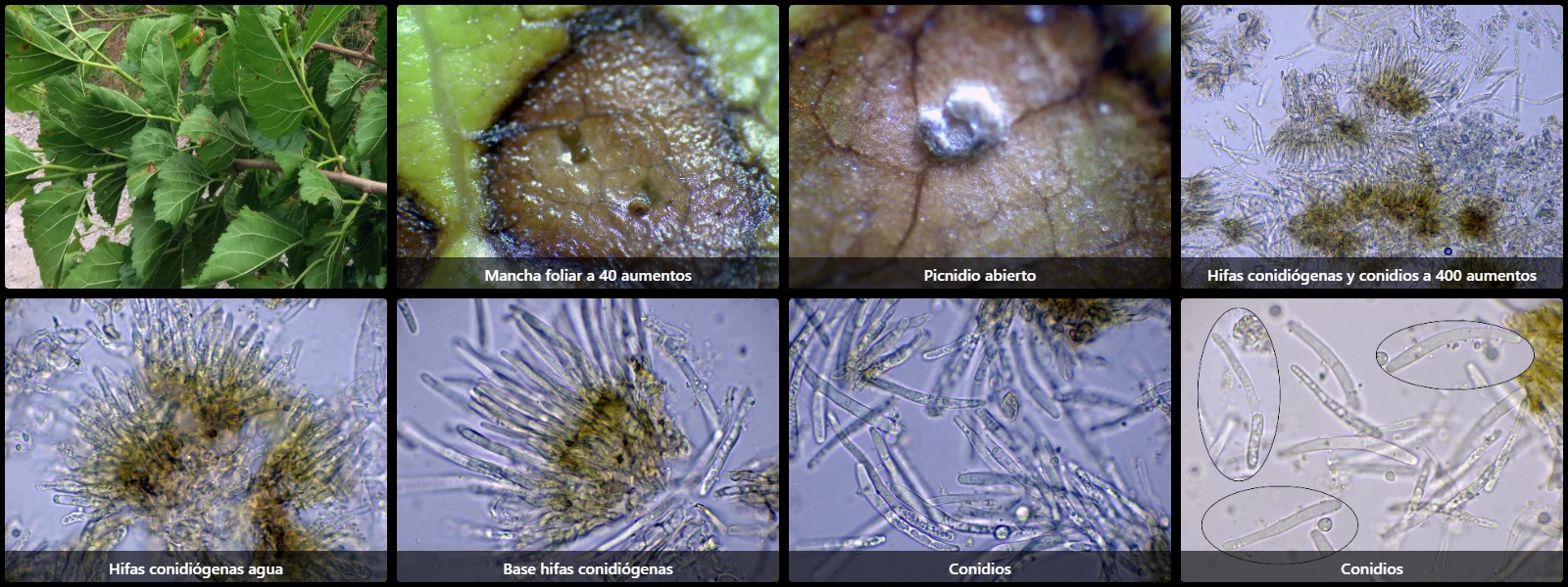 Microscopía de Neophloeospora maculans