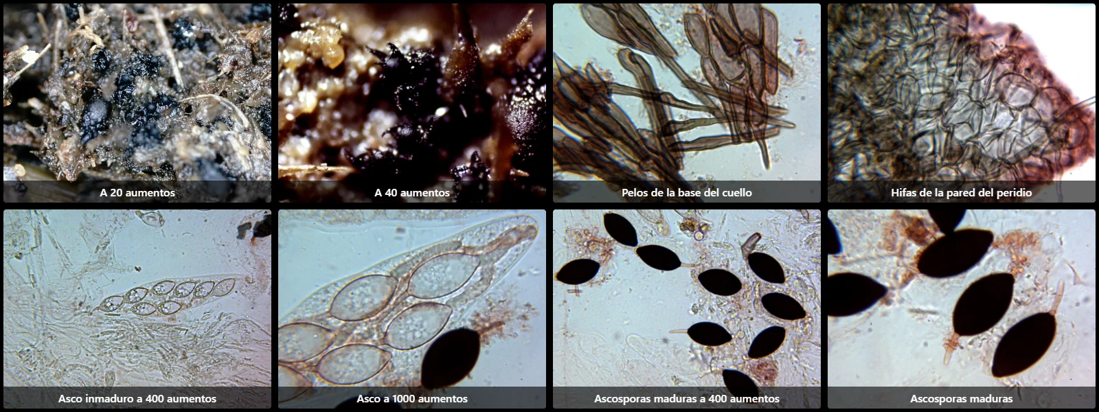 Microscopía de Neoschizothecium aloides