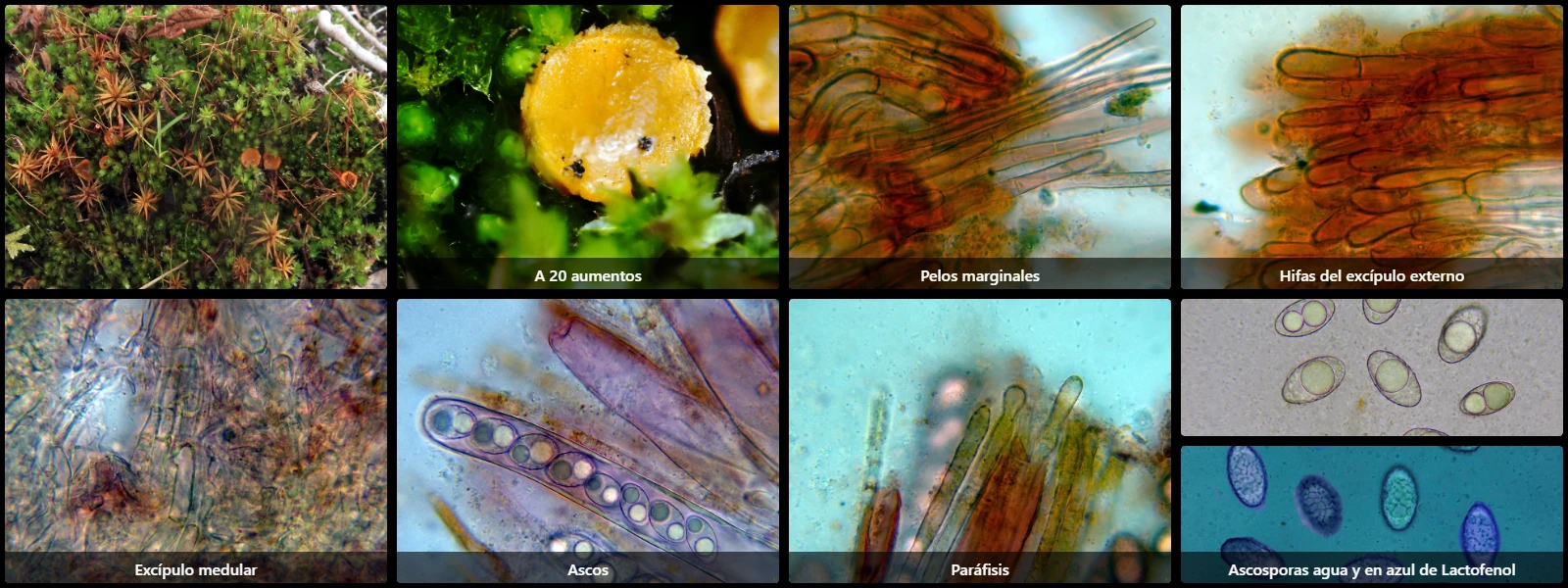 Microscopía de Neottiella rutilans