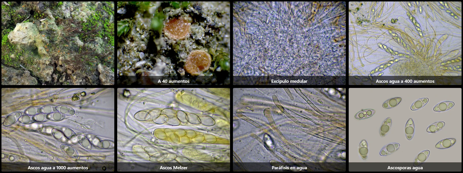 Microscopía de Octospora gemmicola