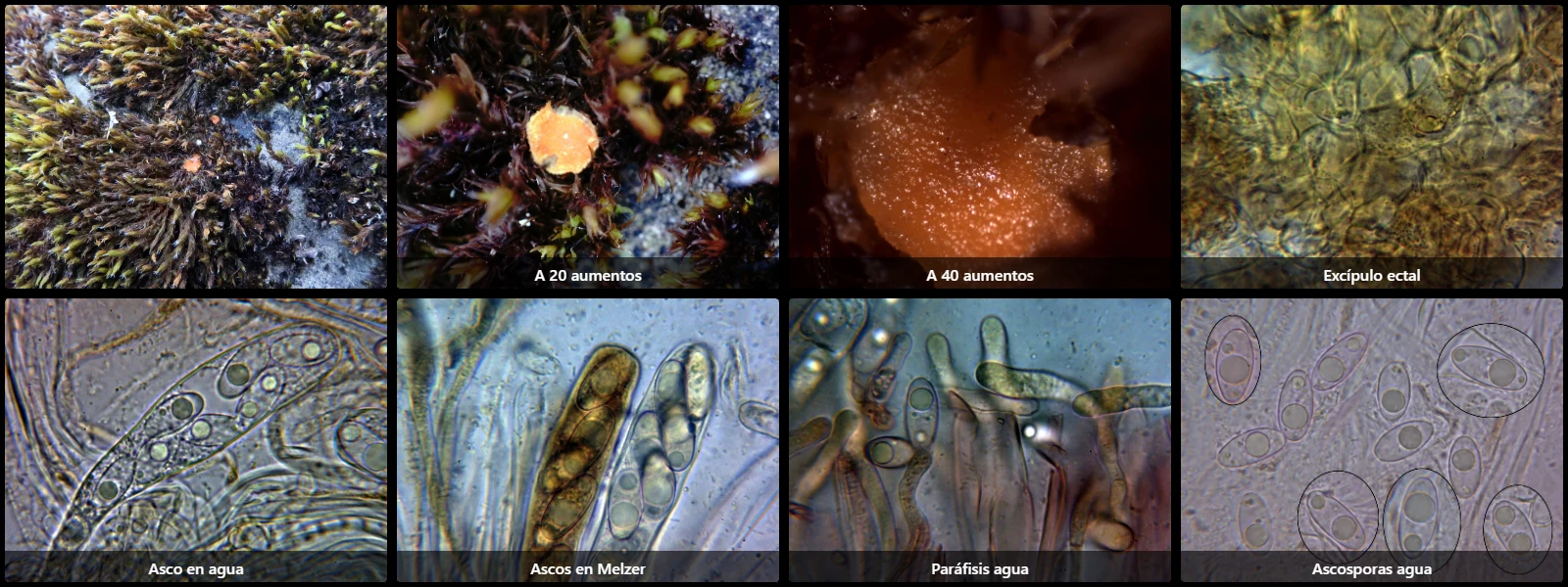 Microscopía de Octospora musci-muralis