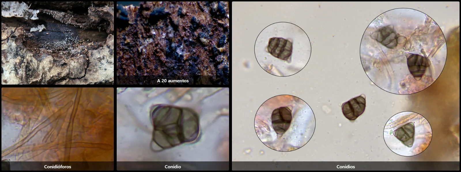 Microscopía de Oncopodiella trigonella