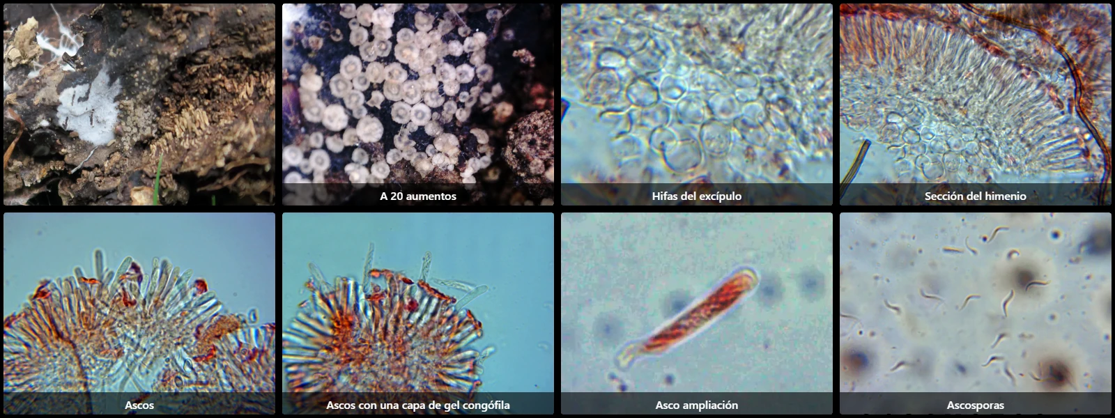 Microscopía de Orbilia crenatomarginata